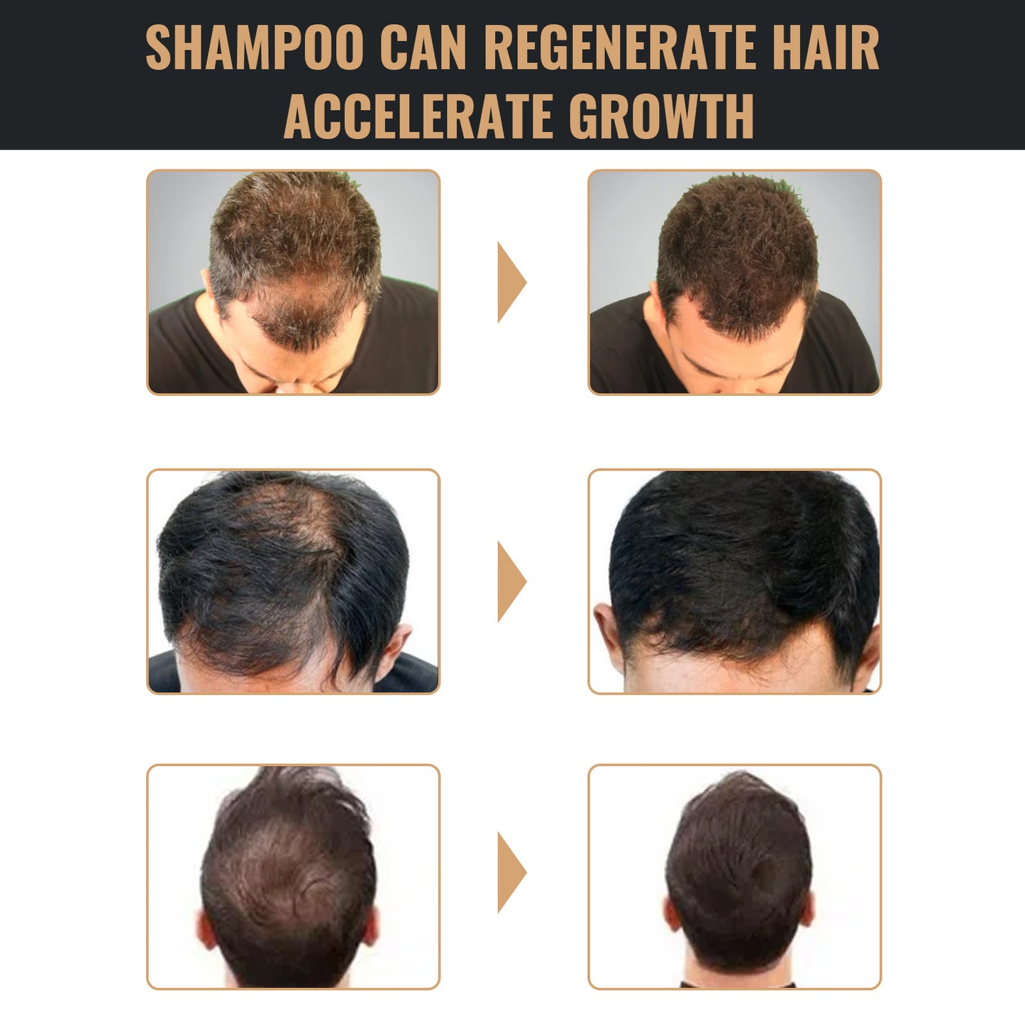 Unisex Hair Regrowth Shampoo