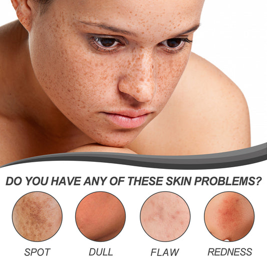 Facial Black Spot Repair