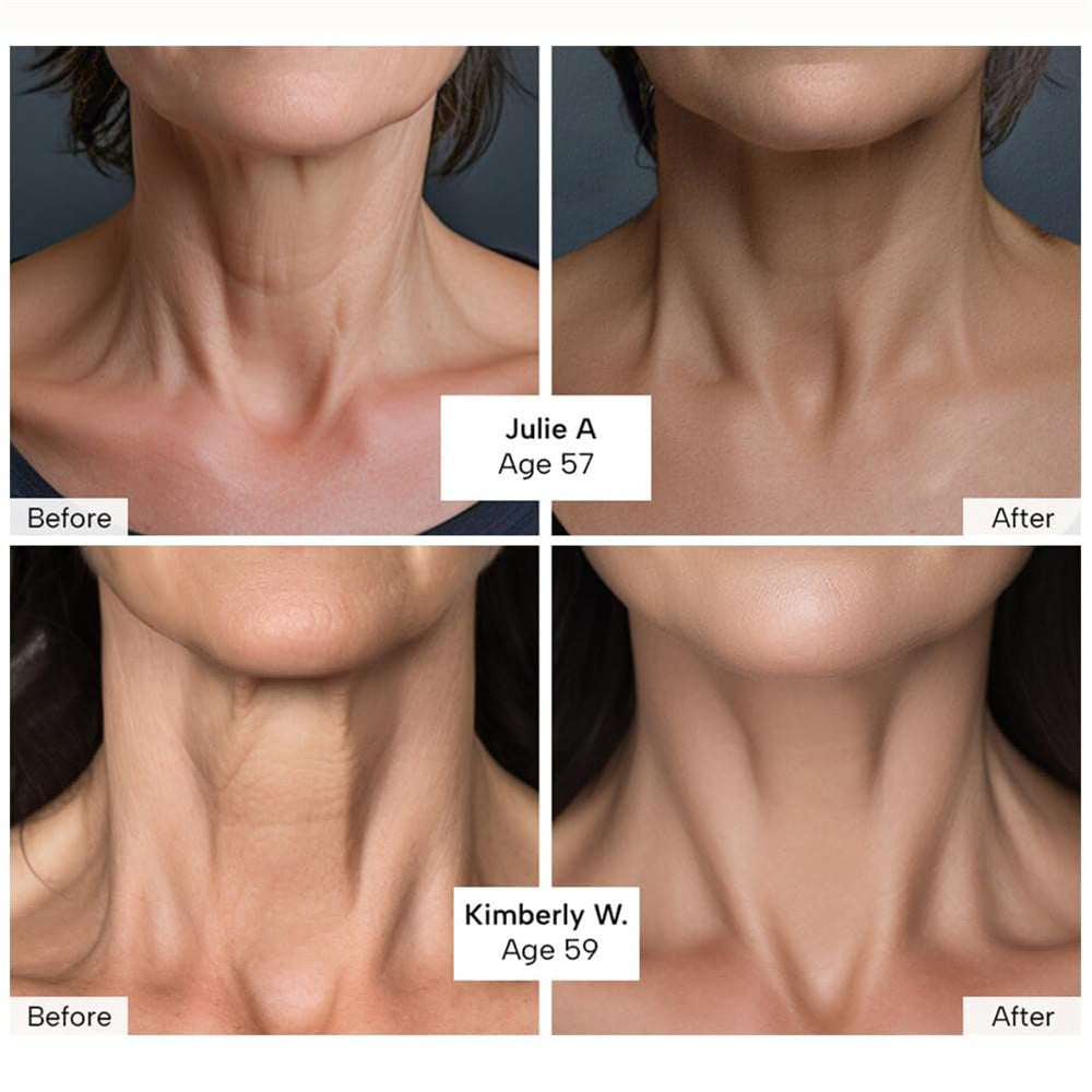 Neck Tightening Cream