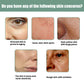 Protein Anti Aging