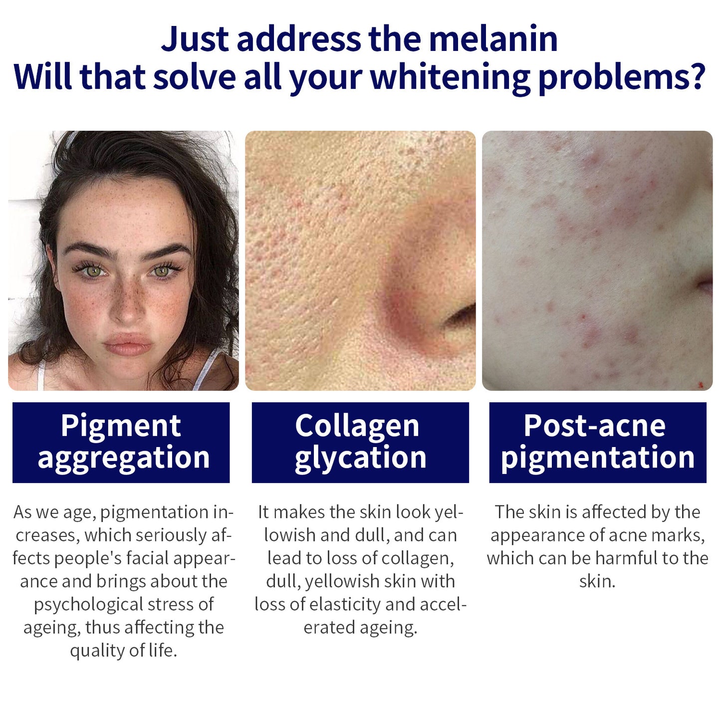 Facial  Freckle Removing Care Solution