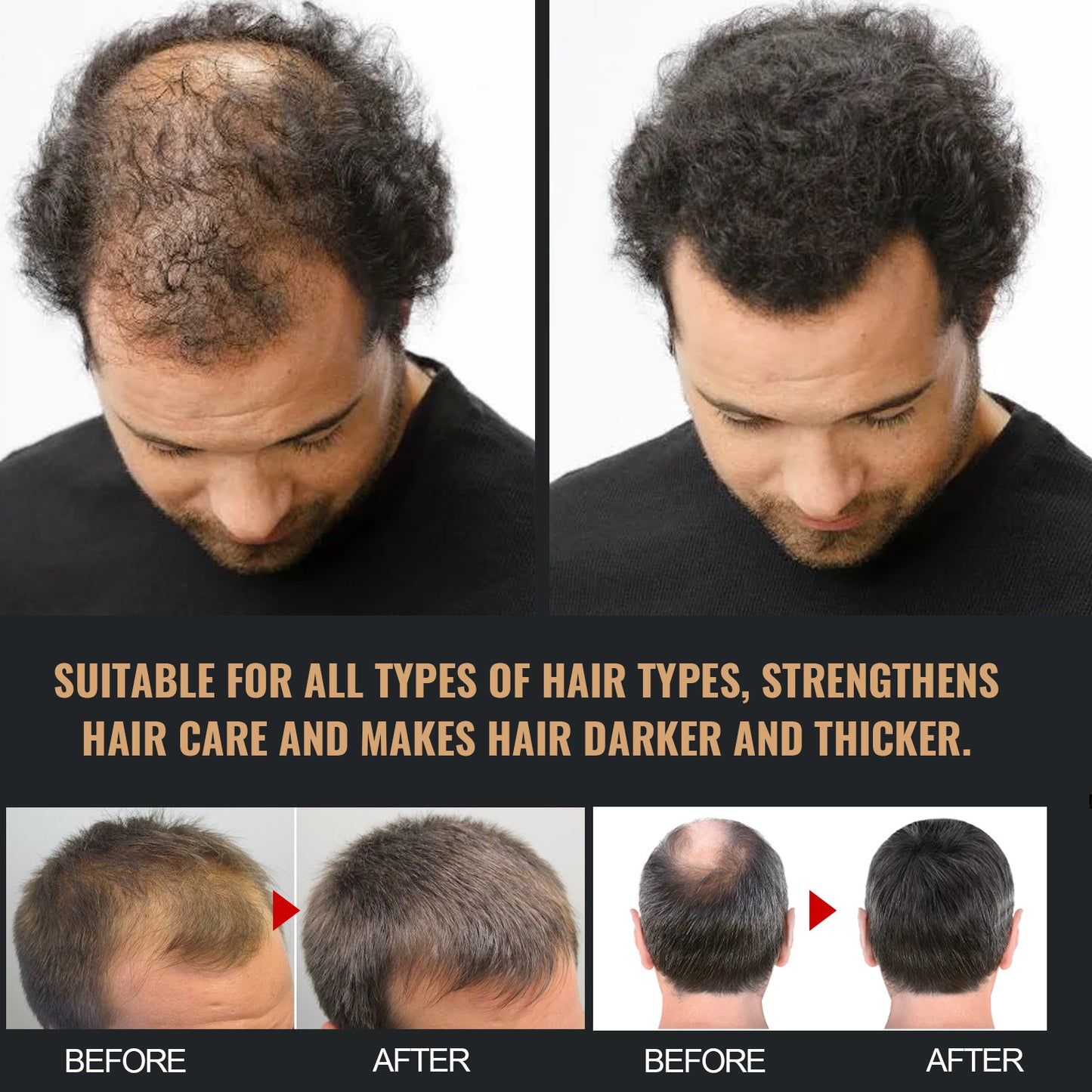Unisex Hair Regrowth Shampoo