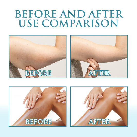 Sunburn Reliever